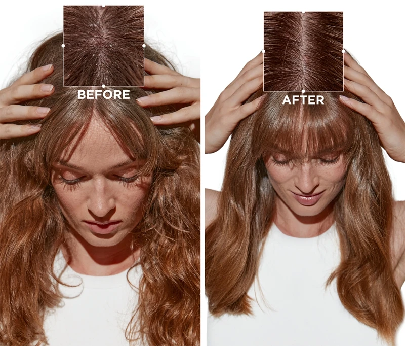 Kérastase Symbiose Micro-Peeling Cellulaire 7 Kérastase Symbiose Micro-Peeling Cellulaire – Image 7