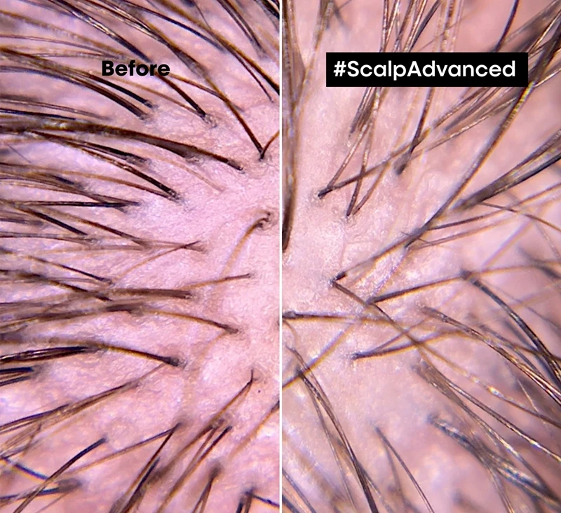 L’Oréal Professionnel Serie Expert Scalp Advanced 2 L’Oréal Professionnel Serie Expert Scalp Advanced – Image 2